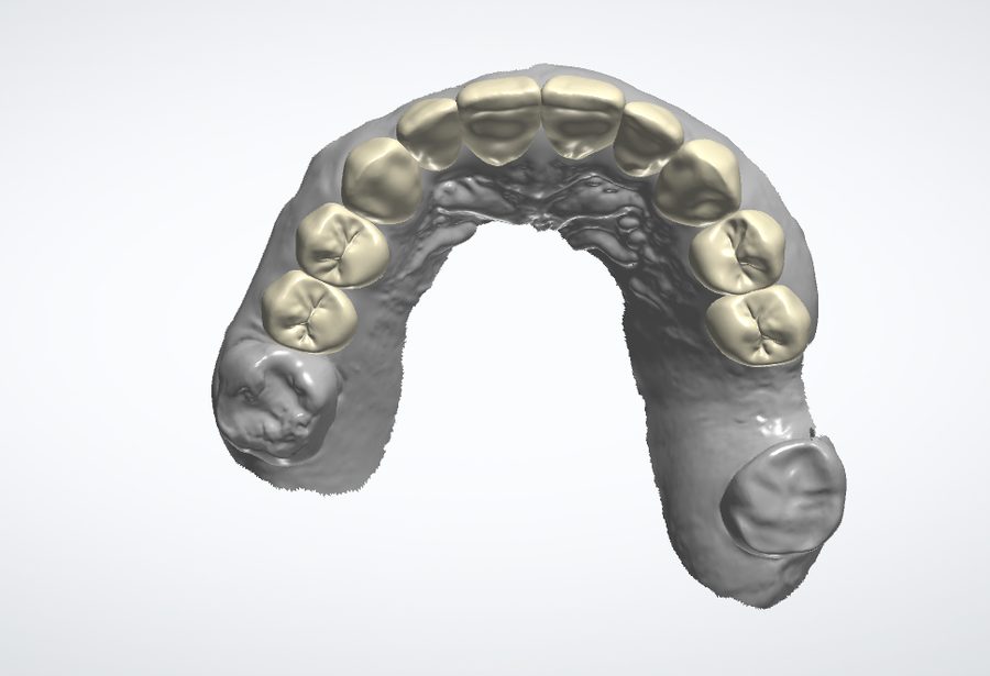 Digital Smile Design — occlusal view