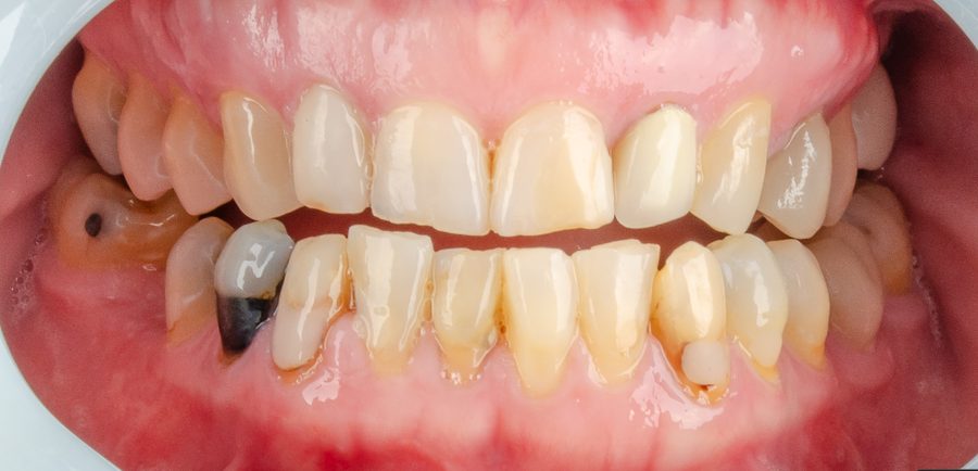 Digital Smile Design — patient photo